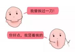 安琪兒孕育精品課|一胎剖了，二胎想順產(chǎn)，來(lái)聽(tīng)
