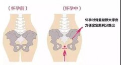 產(chǎn)后修復(fù)第2要素（順產(chǎn)3個月，剖宮產(chǎn)6個月） ——產(chǎn)后無創(chuàng)盆腔康復(fù)工程