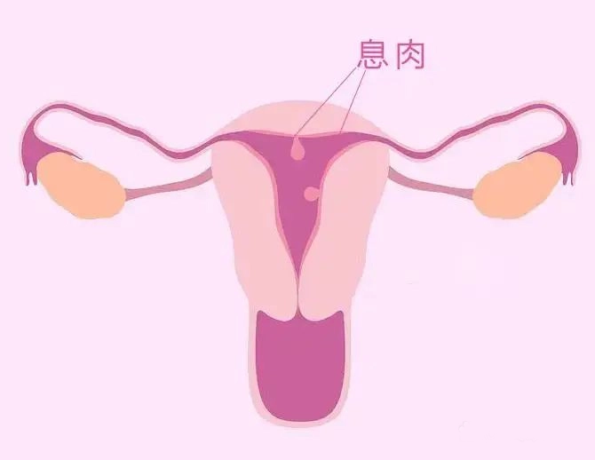 千萬別忽視求子路上的這個“攔路虎”！